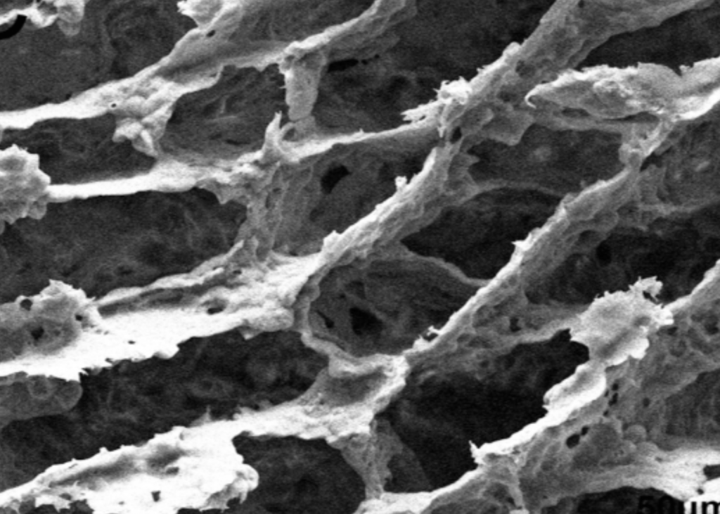 Why Hydroxyapatite Matters in Resorbable Bone Implants: What the PBLG-g-HA/PLLA Study Shows